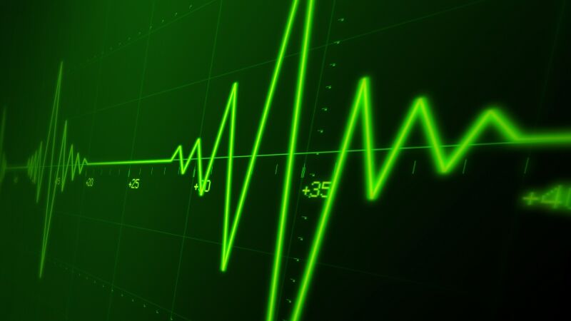 Der richtige Puls beim Training